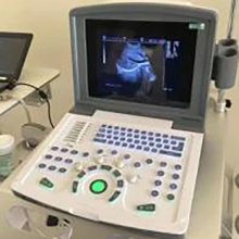 Portable black and white ultrasound machine/ultrasound diagnostic device/Mairuis same model outpatient non color ultrasound machine /Default KRC3.5 Probe